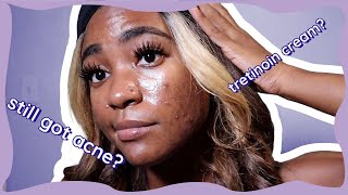 Tretinoin for Hormonal Acne 7 Month Update  My Skin Journey [upl. by Sehguh]