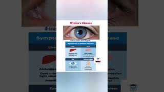 Wilsons DiseaseFreeMedicalEducationld3sfnursingmedicalviralshortsyoutubeviralshortsMbbs [upl. by Ilehs]