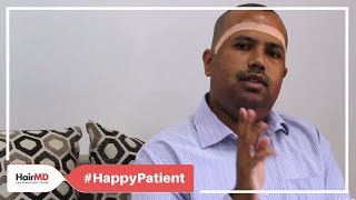 Hair transplant revision testimonial  HairMD Pune [upl. by Brietta901]