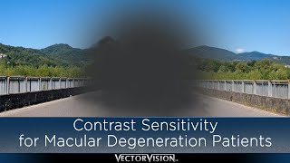 Contrast Sensitivity for Macular Degeneration Patients [upl. by Carter]