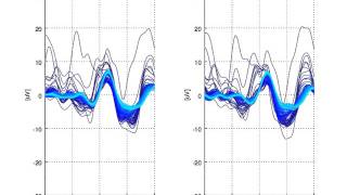 Pattern Reversal Visual Evoked Potentials PRVEPs [upl. by Yltsew]