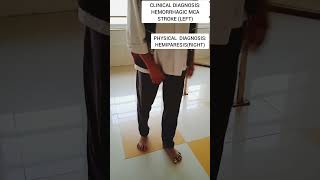 Physical DiagnosisHemiparesisRightcvastroke hemiphysiotherapylearningrehabilitationshorts [upl. by Ahseela]