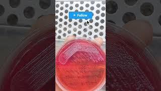 klebsiella in MacConkey Agar। microscope microbiology bacteria youbtube science [upl. by Bainbridge]