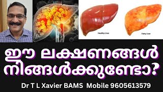 കരൾ രോഗങ്ങൾ  Dr Xavier Reveals Ayurvedic SECRETS for Liver Health [upl. by Lavina461]