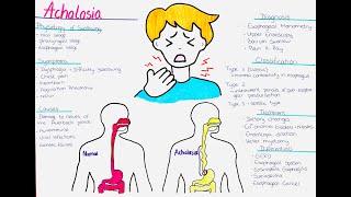 Understanding Achalasia  Causes Symptoms Diagnosis Classification Treatment Differentials [upl. by Ras]