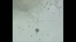 Release of Zoospores by Pythium sp [upl. by Yanffit]