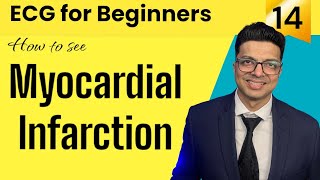 ECG for Beginners  How to see MYOCARDIAL INFARCTION in ECG  जानिए Evolution of MI in ECG [upl. by Downe]