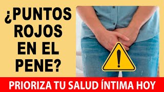 Puntos Rojos En El Glande 💥 Soluciones Efectivas Guía Práctica Sobre La Balanitis [upl. by Astera303]