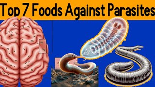 7 Foods Fight Parasites in our body [upl. by Jer]