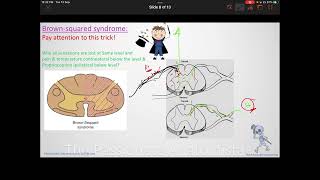 Neuroanatomy VD11 spinal cord injuries [upl. by Olga]