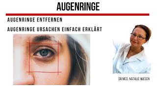 Augenringe ist Ihr Problem Augenringe Ursachen  erklärt von Drmed Natalie Wiesen [upl. by Wagner988]