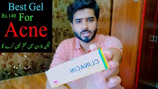 Best Gel For Acne  Acne Treatment At Home  Desi Tips  DFL [upl. by Hares]