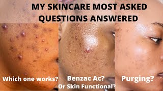 What Really Helped My Acne Pimples Acne SpotsDark Marks [upl. by Victorine]