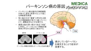 【MEDICA】「パーキンソン病」 川崎医科大学附属病院神経内科 三原雅史部長 [upl. by Nomzaj36]