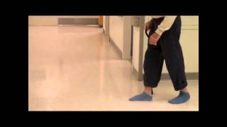 Right Foot Drop in Ambulating Patient  NEJM [upl. by Tempest918]