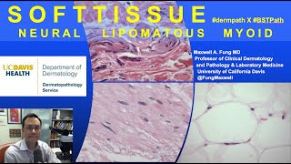 DERMATOPATHOLOGY Soft Tissue Tumors Neural Lipomatous Myoid [upl. by Peacock]