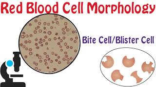 Red Blood Cell Morphology Part 5  Bite and Blister cell [upl. by Shirlee]