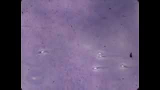 Fascinating lab footage of sperm [upl. by Ecnerrot]