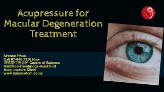 Acupressure for Macular Degeneration TreatmentAcupunctureclinichamiltonCambridgeAuckland [upl. by Spanos58]