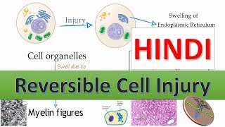 Reversible Cell Injury with Histological slide in Hindi [upl. by Airbas]