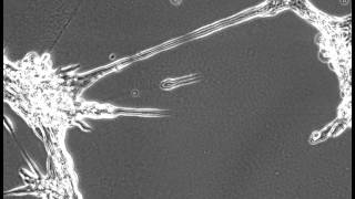 hCMEC Tube Formation Assay [upl. by Eatnom]