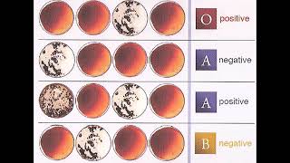 Understanding Blood Type Results  Review and Practice [upl. by Peterus]