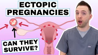 What Is Ectopic Pregnancy Ectopic Pregnancy Symptoms amp Ectopic Pregnancy Risk Factors [upl. by Hedvig]