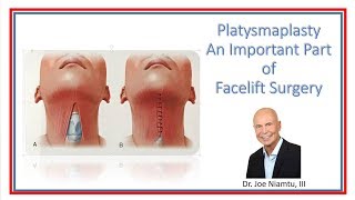 Platysmaplasty A most Important Part of a Facelift [upl. by Eicaj]