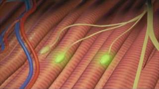 Lélectromyographie EMG   Electromyography [upl. by Aiuqal848]