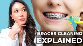 How to keep my braces clean [upl. by Niatsirt]