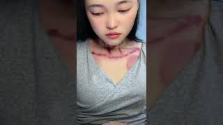 kerokanguasha kerokan cupping massage [upl. by Aneris]