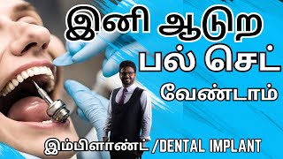 Fixed பல் கட்டும் முறைஇம்ப்ளாண்ட் சிகிச்சைDental Implant Treatment in TamilPal kattuvathu eppadi [upl. by Lachish]