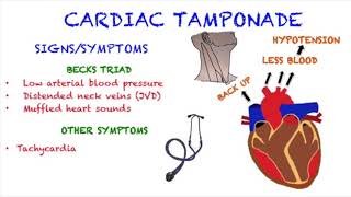 Cardiac Tamponade [upl. by Norling676]