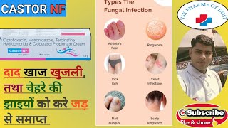 Castor NF Cream Full Hindi Review [upl. by Samid]