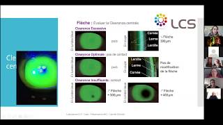 AKS  une adaptation scleral de A a Z [upl. by Aronow738]