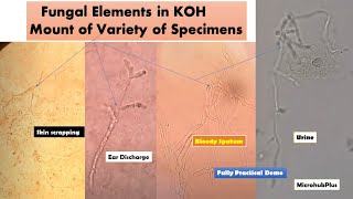 KOH mount of various samples with variety of Fungal elements [upl. by Line186]