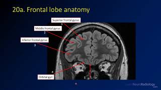 Neuroradiology review  brain gyral anatomy [upl. by Ahsinelg]