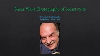 Shear wave elastography of the breast cysts [upl. by Binetta]