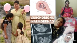 Subchorionic hemorrhage internal bleeding   pregnancy bleeding   My journey   ಕನ್ನಡ [upl. by Nylhsoj834]