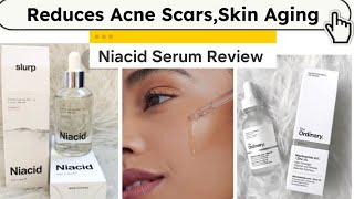 Niacinamide Serum  Niacid Serum  The Ordinary Niacinamide serum Review  Acne Scars serum  Niacid [upl. by Florance214]