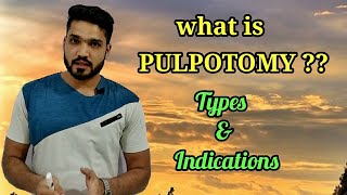 Pulpotomy Indications amp types  which material used in pulpotomy [upl. by Gwenn968]