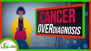 When You Have Cancer But Youre Fine Cancer Overdiagnosis [upl. by Ykcir484]