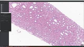 Annotate Glomeruli and Tubules using QuPath and Segment Anything Plugin [upl. by Roch215]