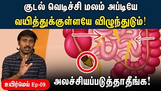 யாருக்கெல்லாம் appendix பிரச்சனை வரும்  Appendicitis explained in Tamil  Uyirmei EP  09 [upl. by Annaor263]