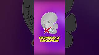 ¿Sabías que la ENFERMEDAD DE HIRSCHSPRUNG comienza en el vientre 🚼 embriologia embarazo shorts [upl. by Kotz727]