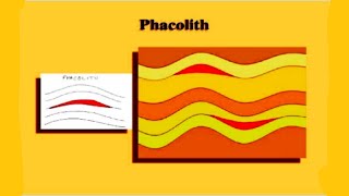 What is Phacolith in Hindi [upl. by Aerdnod243]