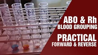 Blood Grouping Test  Principle and procedure  Cell Grouping  Serum Grouping [upl. by Morry]