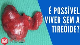 🔴 É possível viver sem a tireóide  Dr Tireóide Responde 39 [upl. by Eentirb175]