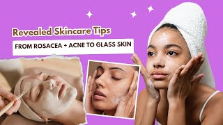 I reviewed ROBINS journey From rosacea  acne to glass skin The science of selfcare [upl. by Jempty]