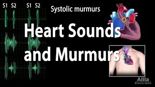 Heart Sounds and Heart Murmurs Animation [upl. by Cutcheon]